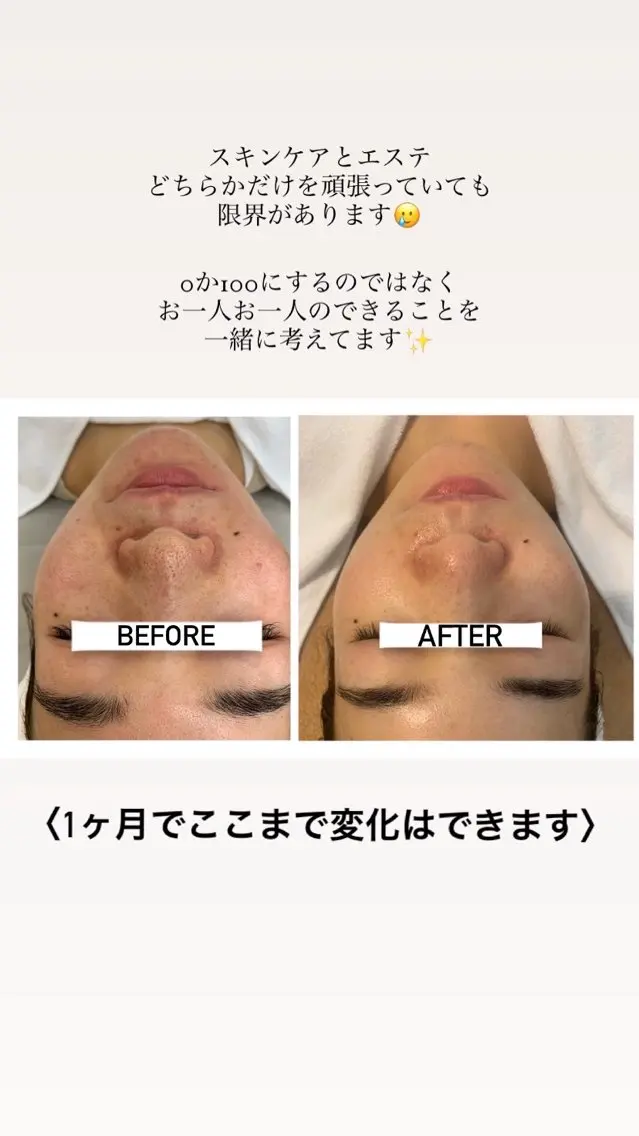 〈毎月3名様まで〉即効性を感じたい方にオススメ🤍の写真