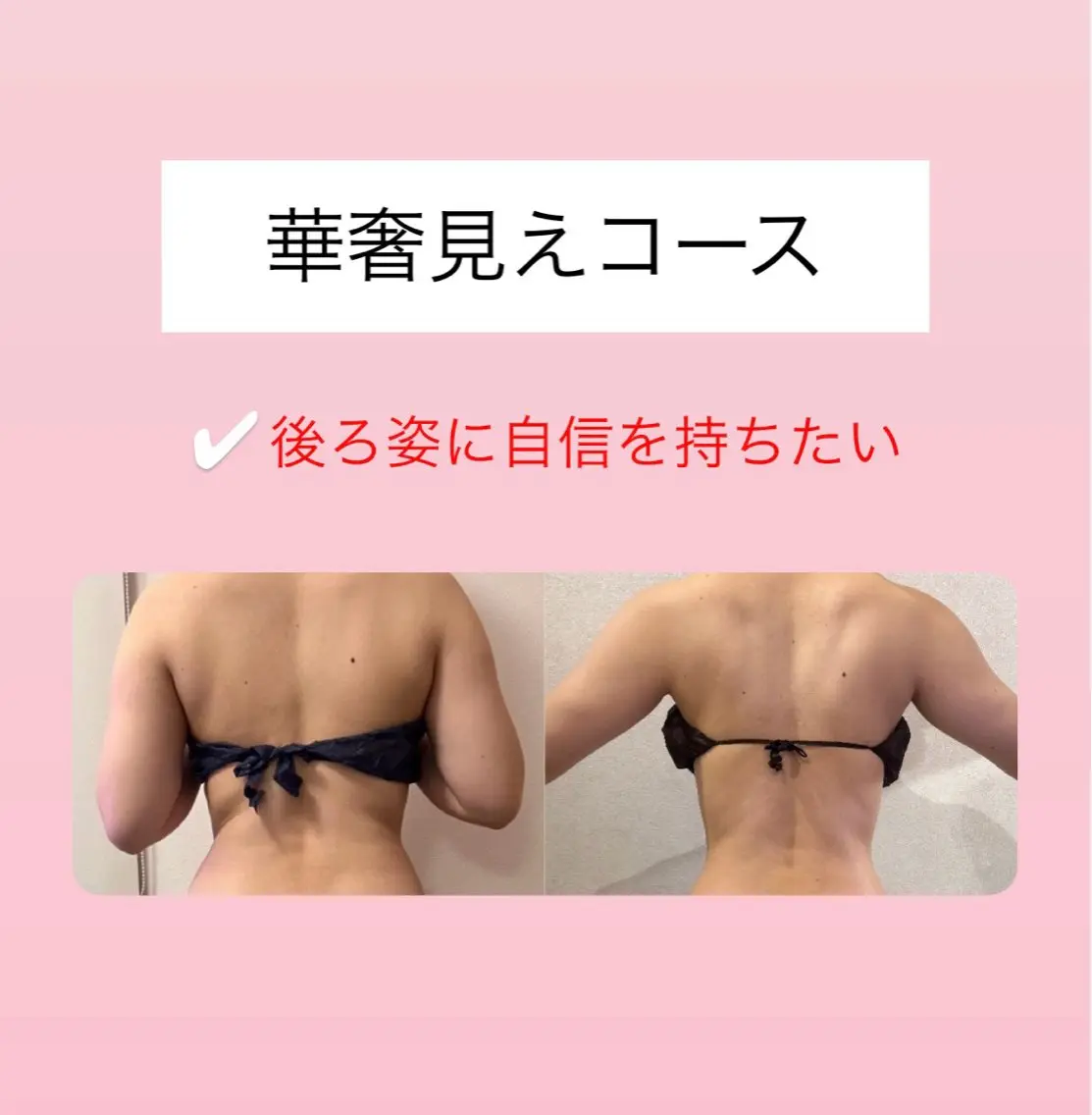 その他 Raviy 【痩身専門・肌管理】のエステ・リラクイメージ