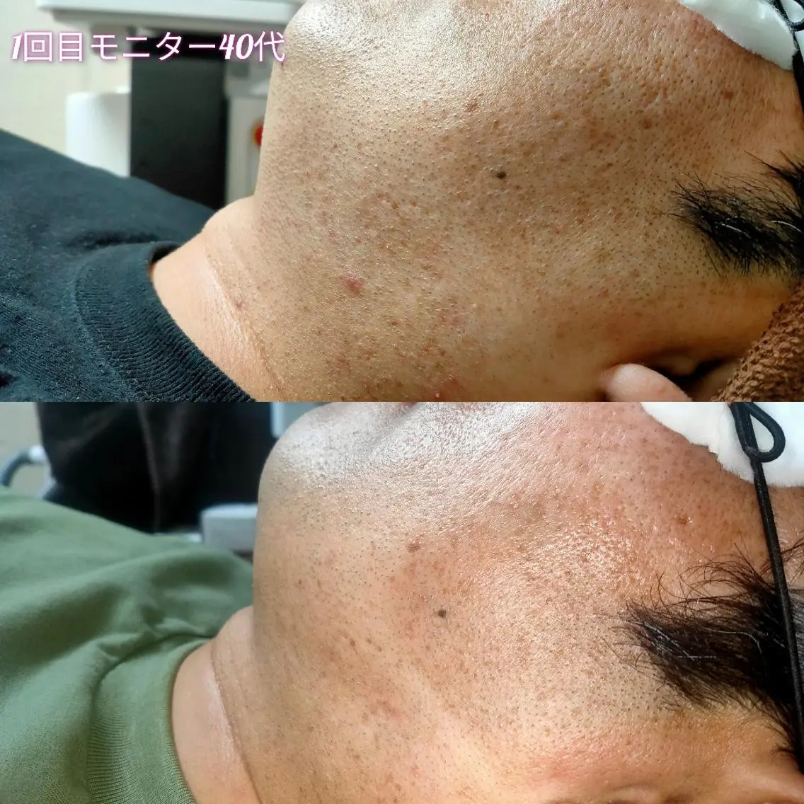 メンズ 脱毛 武 藤のエステ・リラクイメージ