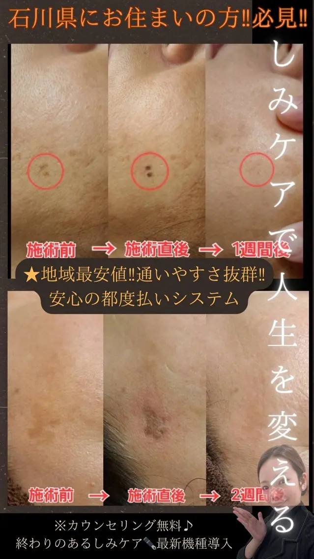 エステ LiZA エステティックサロンのエステ・リラクイメージ