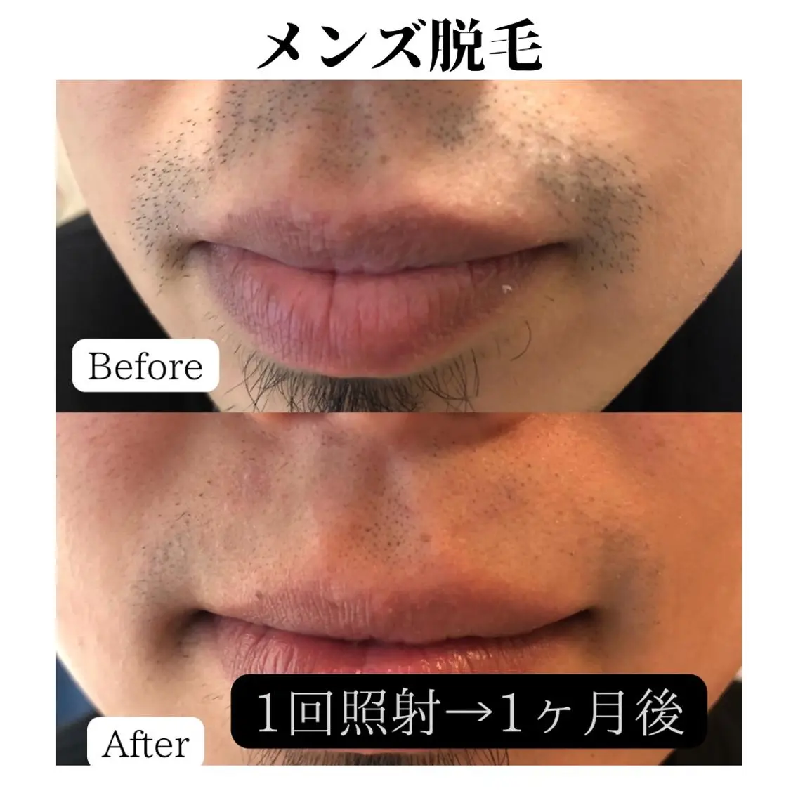 トータルビューティー サロンSalaのマツエク・マツパデザイン