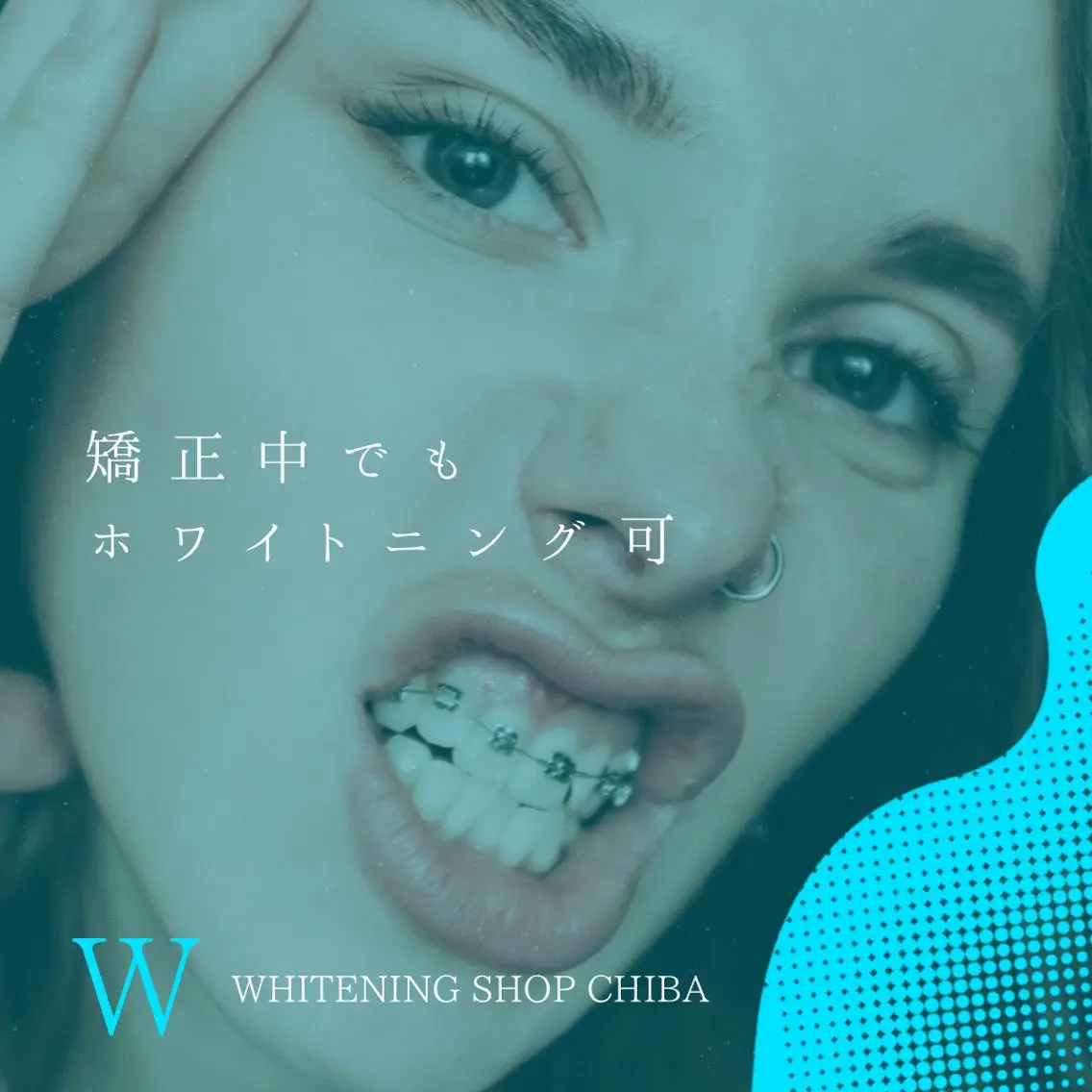 メンズ エステ ホワイトニング ショップ千葉店のその他イメージ