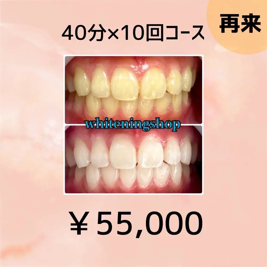 【2回目以降ご来店の方も回数券ご購入可能です🥰】40分×10回照射✨の写真