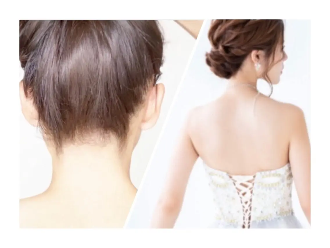 【自分で出来ない所だけケア!】レディース脱毛★うなじ+背中(シェービング込)の写真