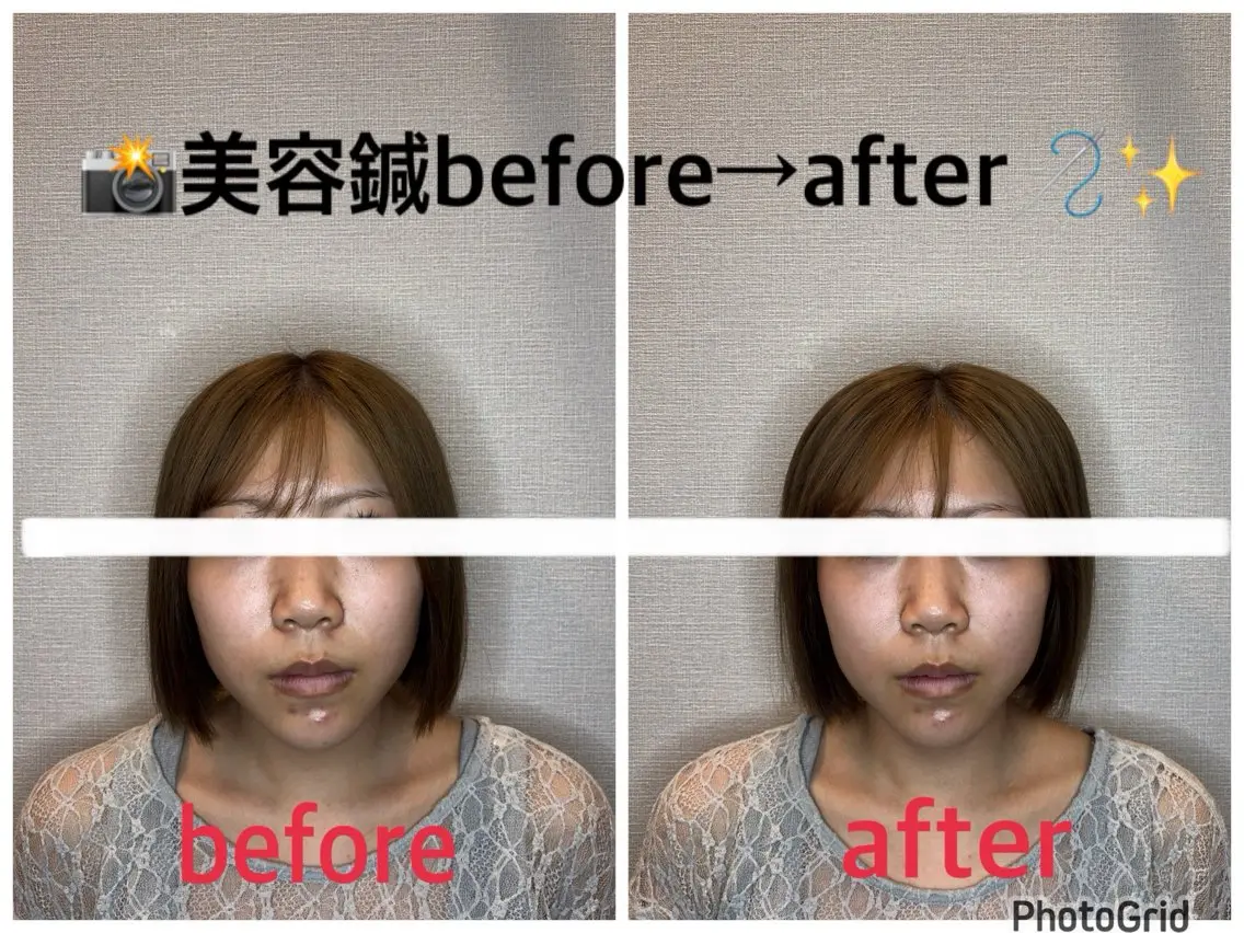 小林整骨院本町 美容鍼roomのエステ・リラクイメージ