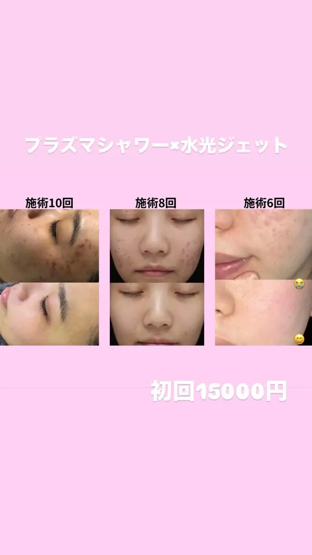 マツエク・マツパ エステ リラク 愛維美水光美肌専門店 メンズレディースokのエステ・リラクイメージ