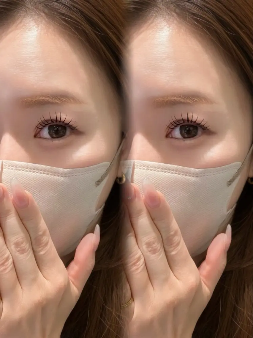 フラットマットラッシュ100本の写真