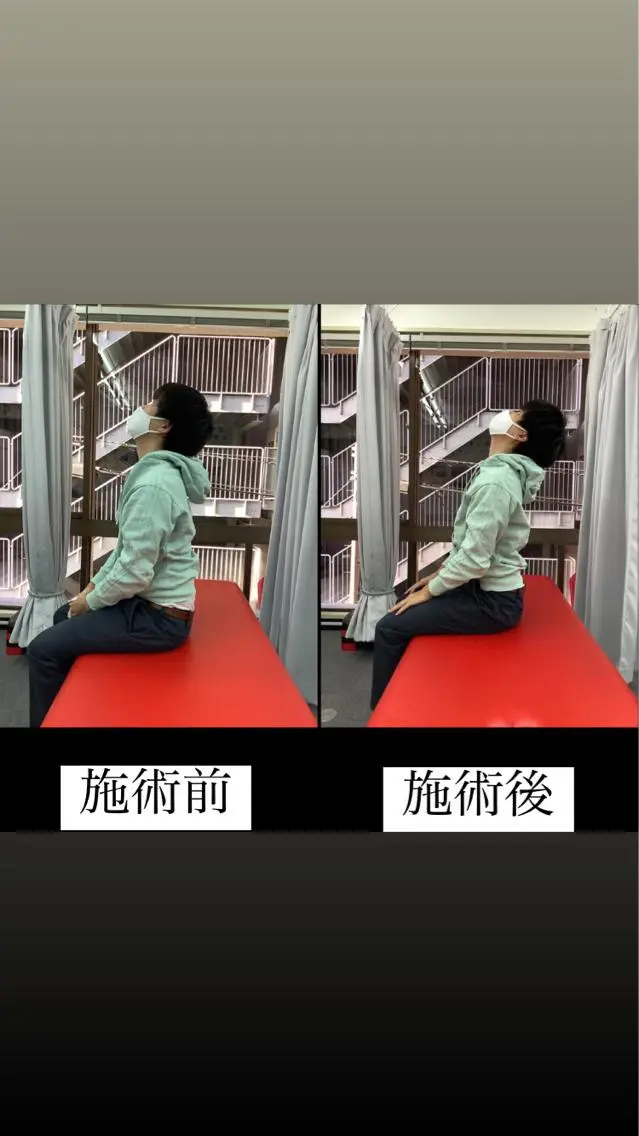 肩こり・首こりケア整体の写真