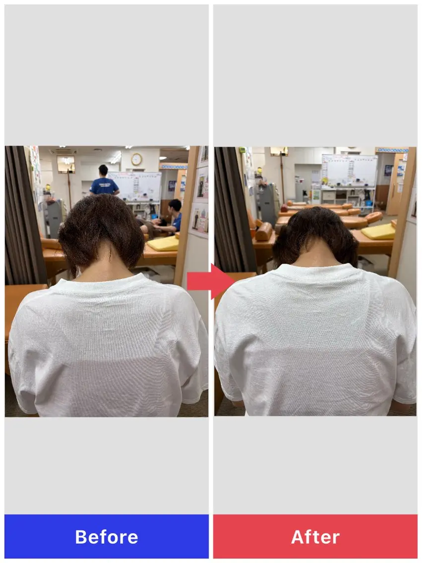 美容鍼×小顔矯正× 美容整体/小林幸司のエステ・リラクイメージ