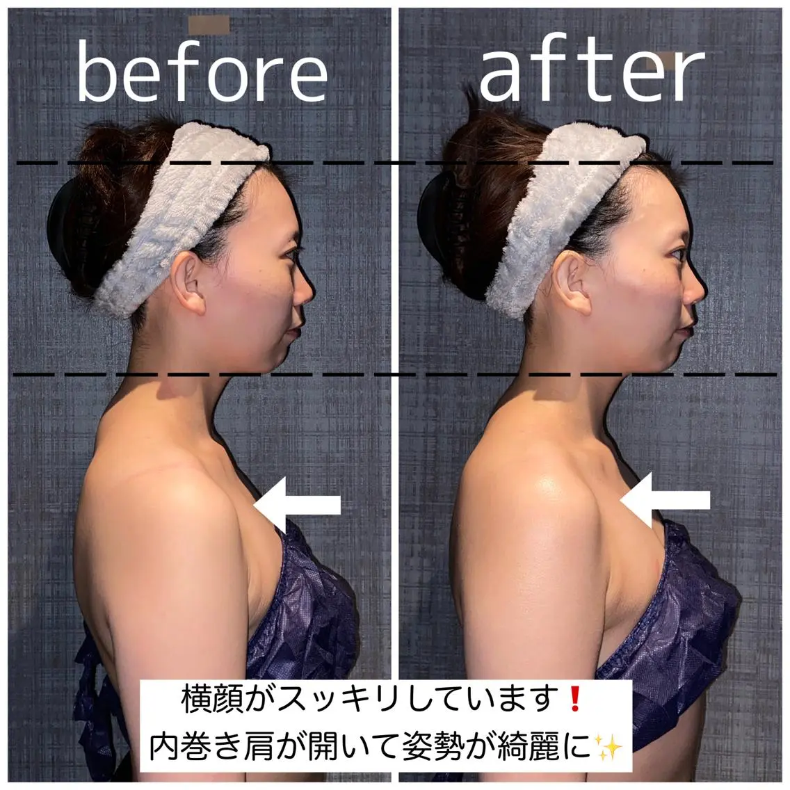 【目線付きモニター❗️残り2名様】こりとりコルギ60分×10回❣️お写真をご提供していただける25歳以上の方限定🌼🌈の写真