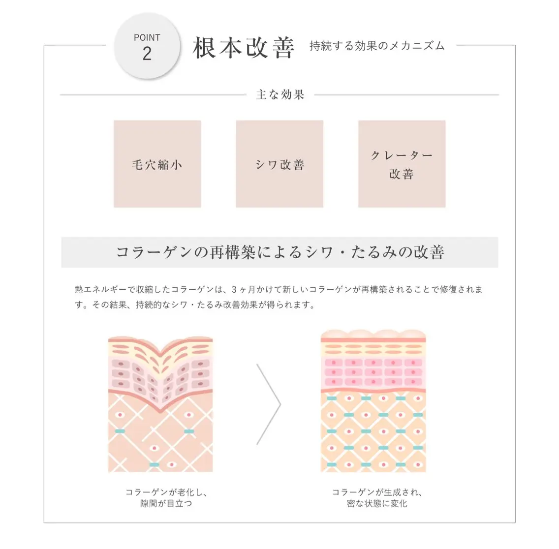 エステ 看護師が施術する美容 ナスサロ/mitoのエステ・リラクイメージ