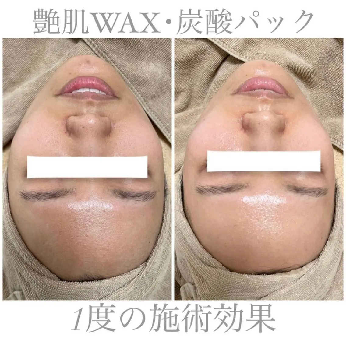 脱毛 エステサロン Mi-mi.iのエステ・リラクイメージ