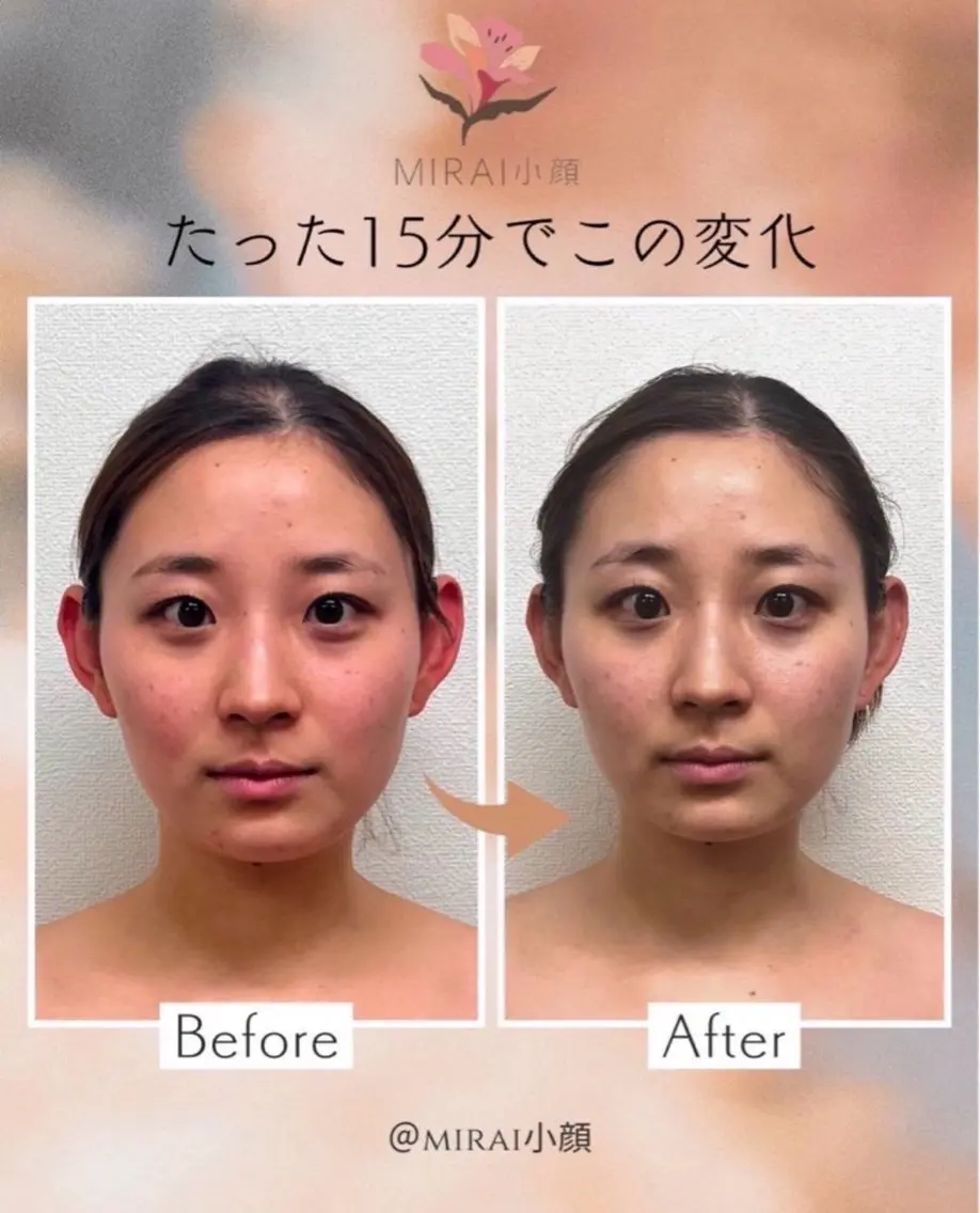 エステ MIRAI小顔名古屋 YUIのエステ・リラクイメージ