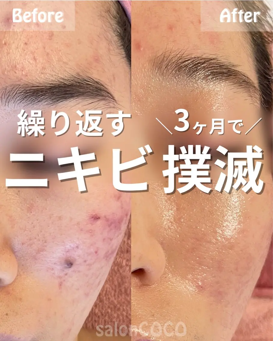 エステ リラク 素肌再建看護師💎 salonCOCOのエステ・リラクイメージ