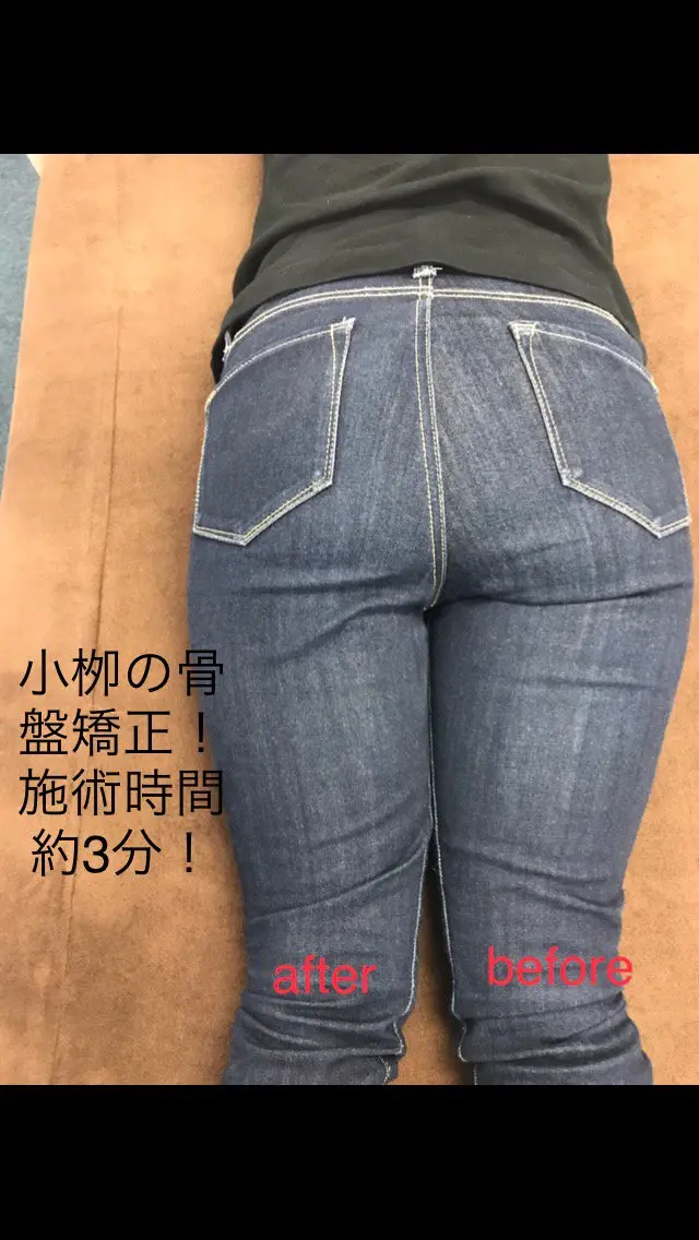 痩せる骨盤矯正の写真