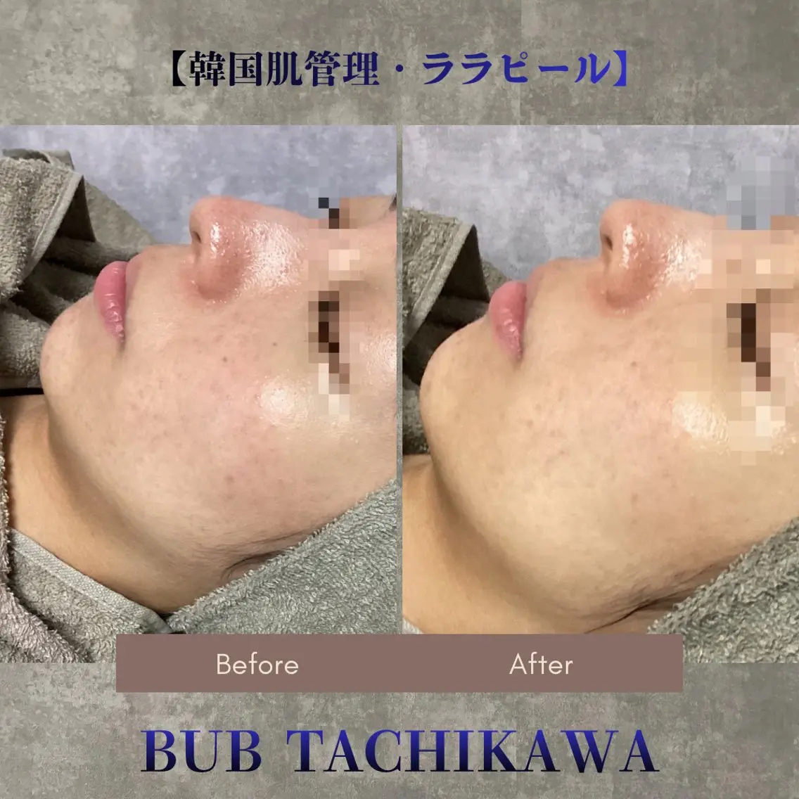 メンズ 【BUB立川】 ゆかのエステ・リラクイメージ