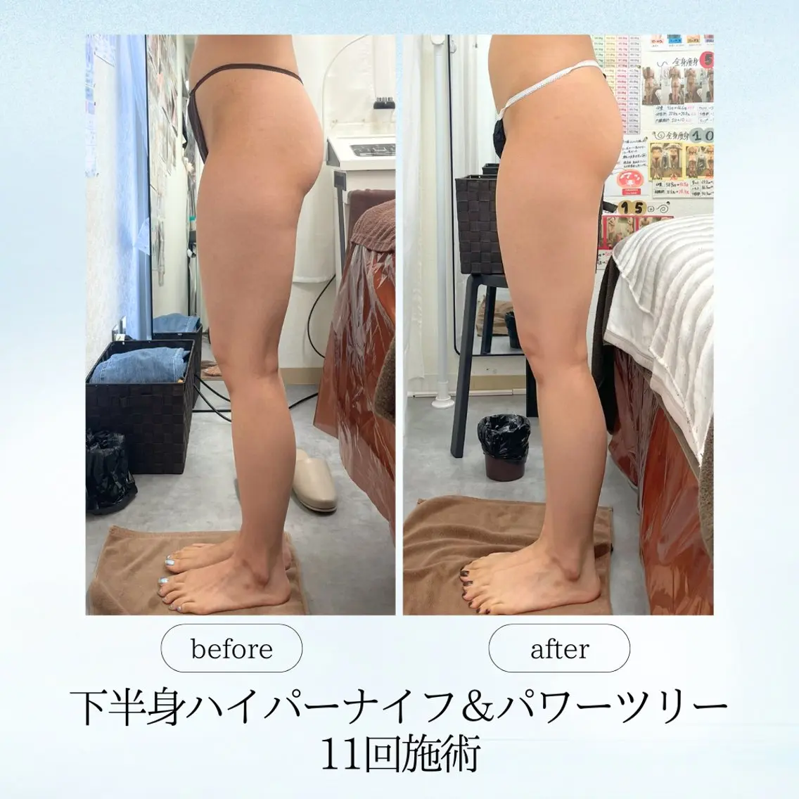 エステ リラク 《痩身、小顔専門店》 エスプレッソのエステ・リラクイメージ