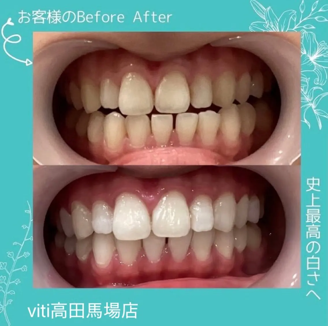 その他 viti 高田馬場店のその他イメージ