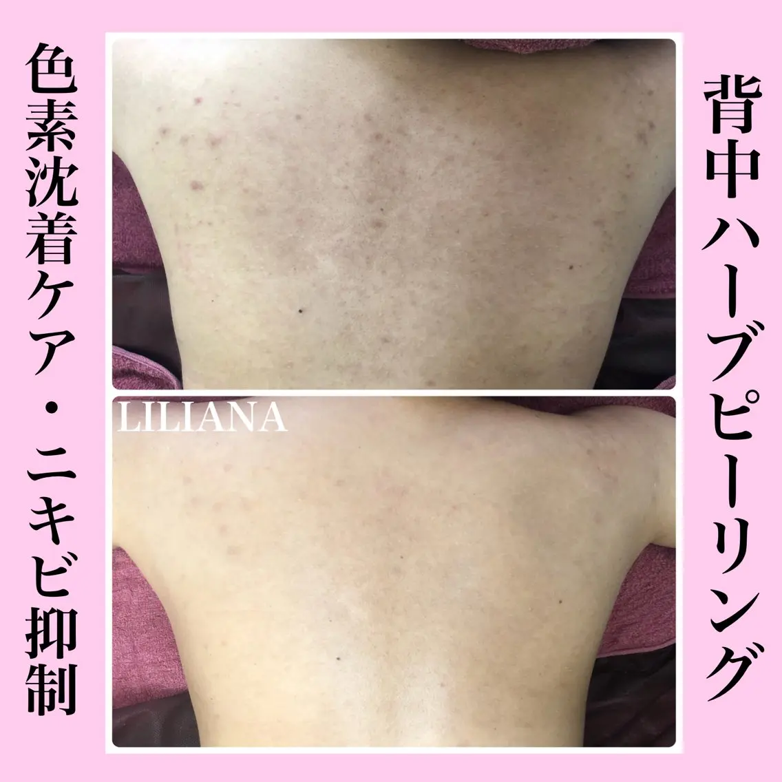 エステ LILIANA ☆YURIのエステ・リラクイメージ