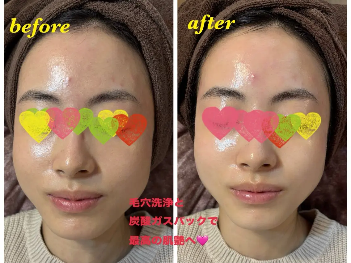 美肌❤️美眉 結果重視サロン✨のエステ・リラクイメージ