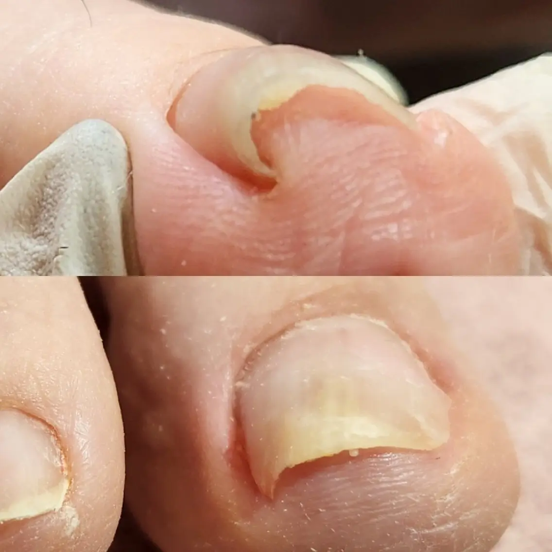 ネイル Micky nail chikushinoのその他イメージ