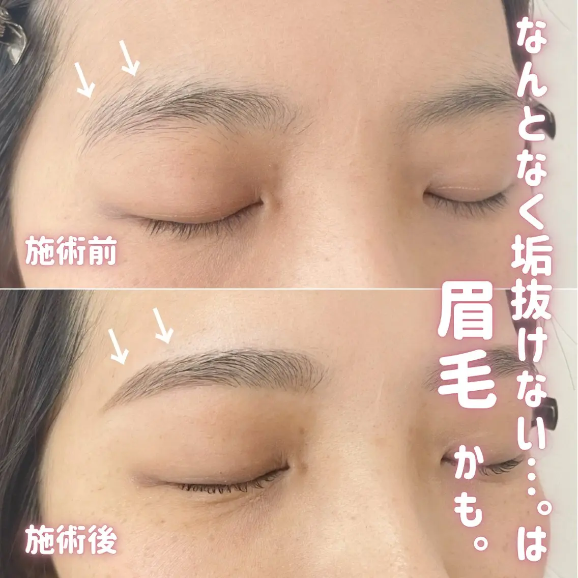 アイブロウ ワックス脱毛 その他(アイブロウ) Callana KAYOのエステ・リラクイメージ