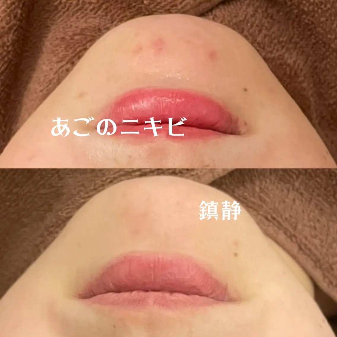 触れたくなる モテ肌へ...❤︎のエステ・リラクイメージ