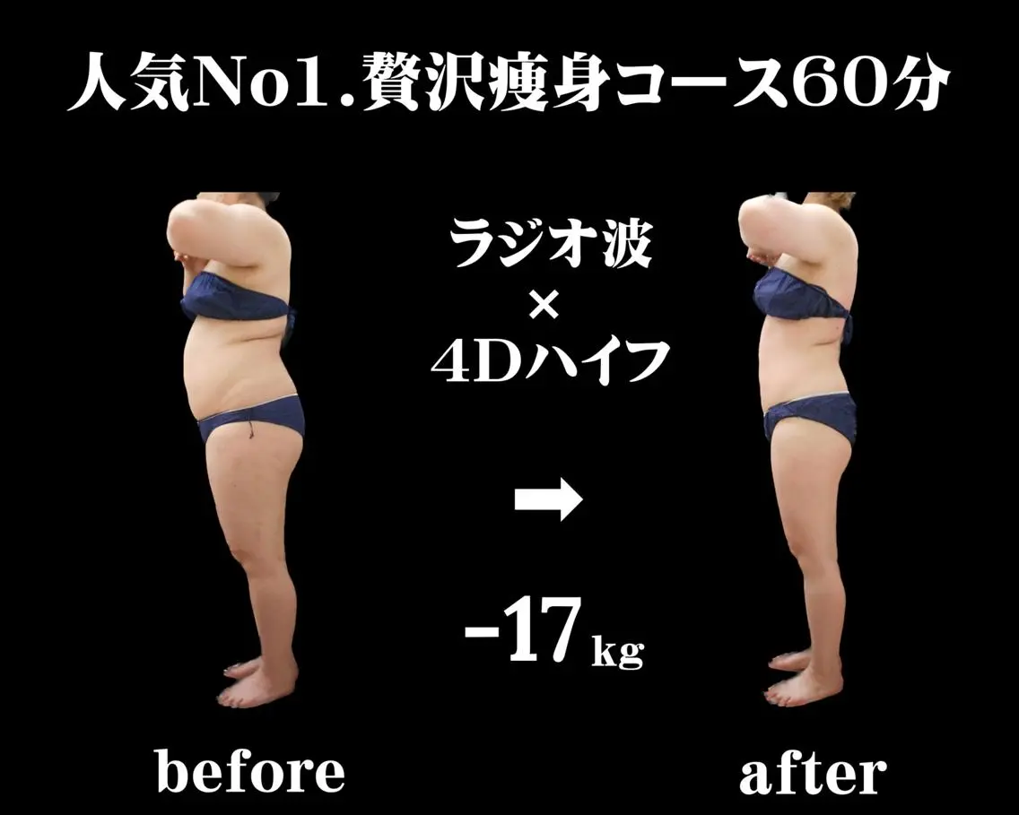◎成功者続出メニュー★お悩みパーツ集中シェイプアップ60分の写真