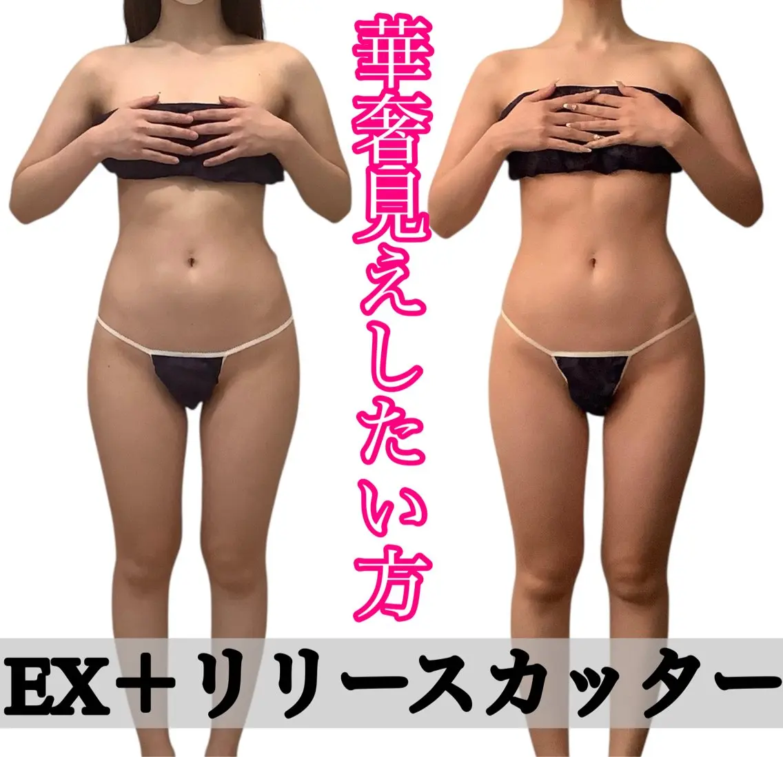 痩身ダイエット&小顔 🩷アールズスリムのエステ・リラクイメージ