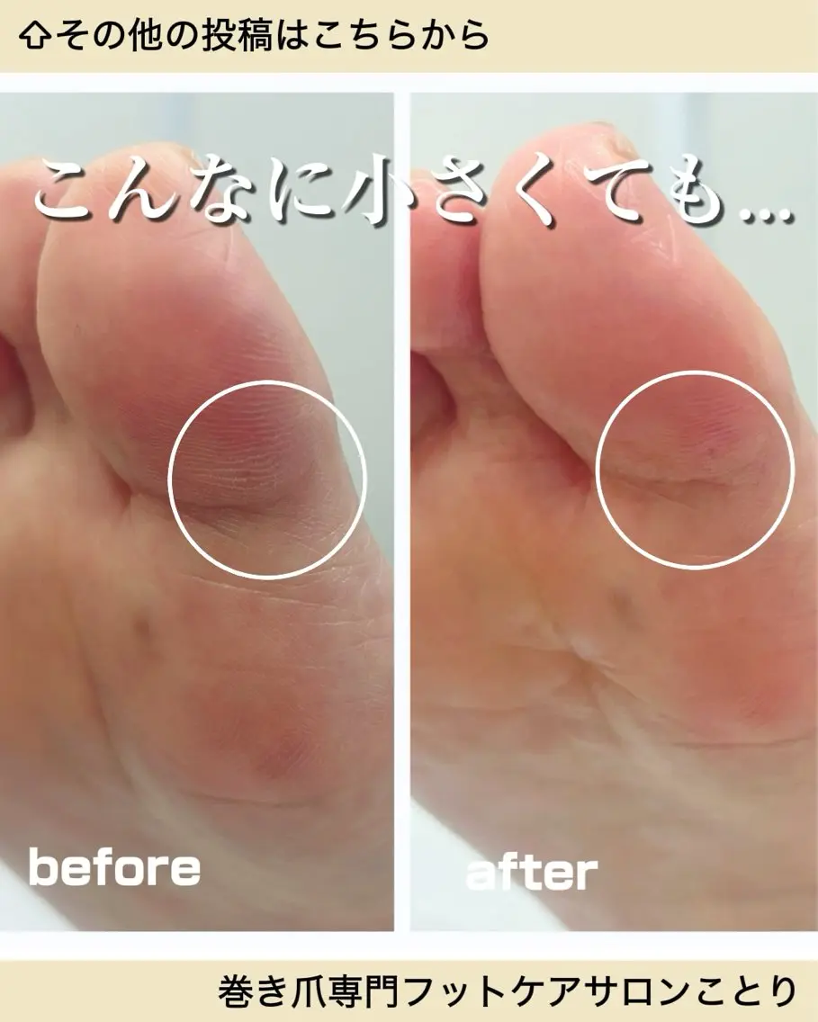 その他 フットケアサロン Kotoriのその他イメージ