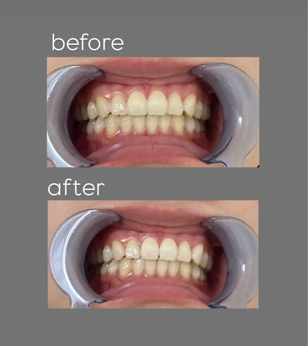 aoi 🦷❤︎のその他イメージ