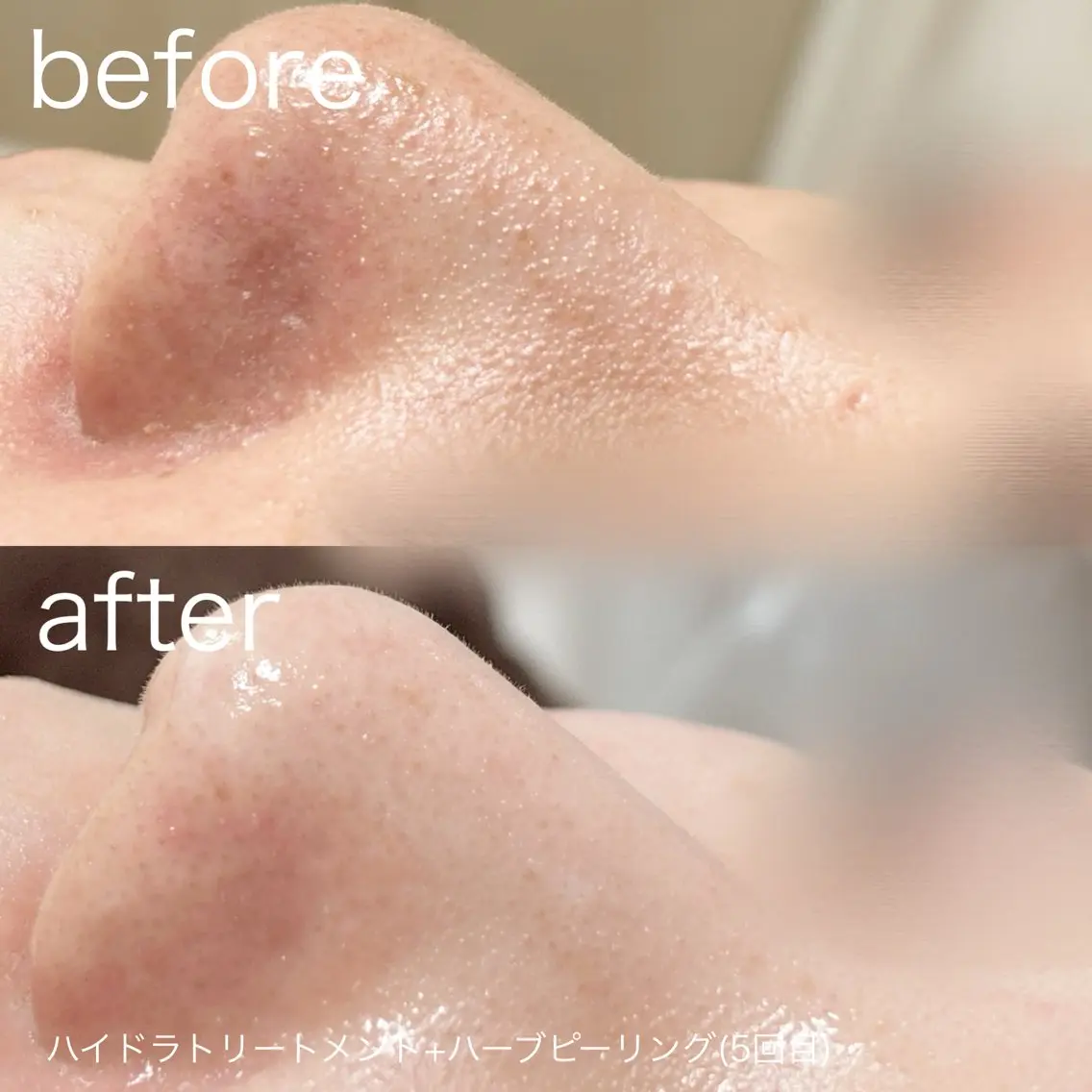 脱毛 lulularico Yuのネイルデザイン