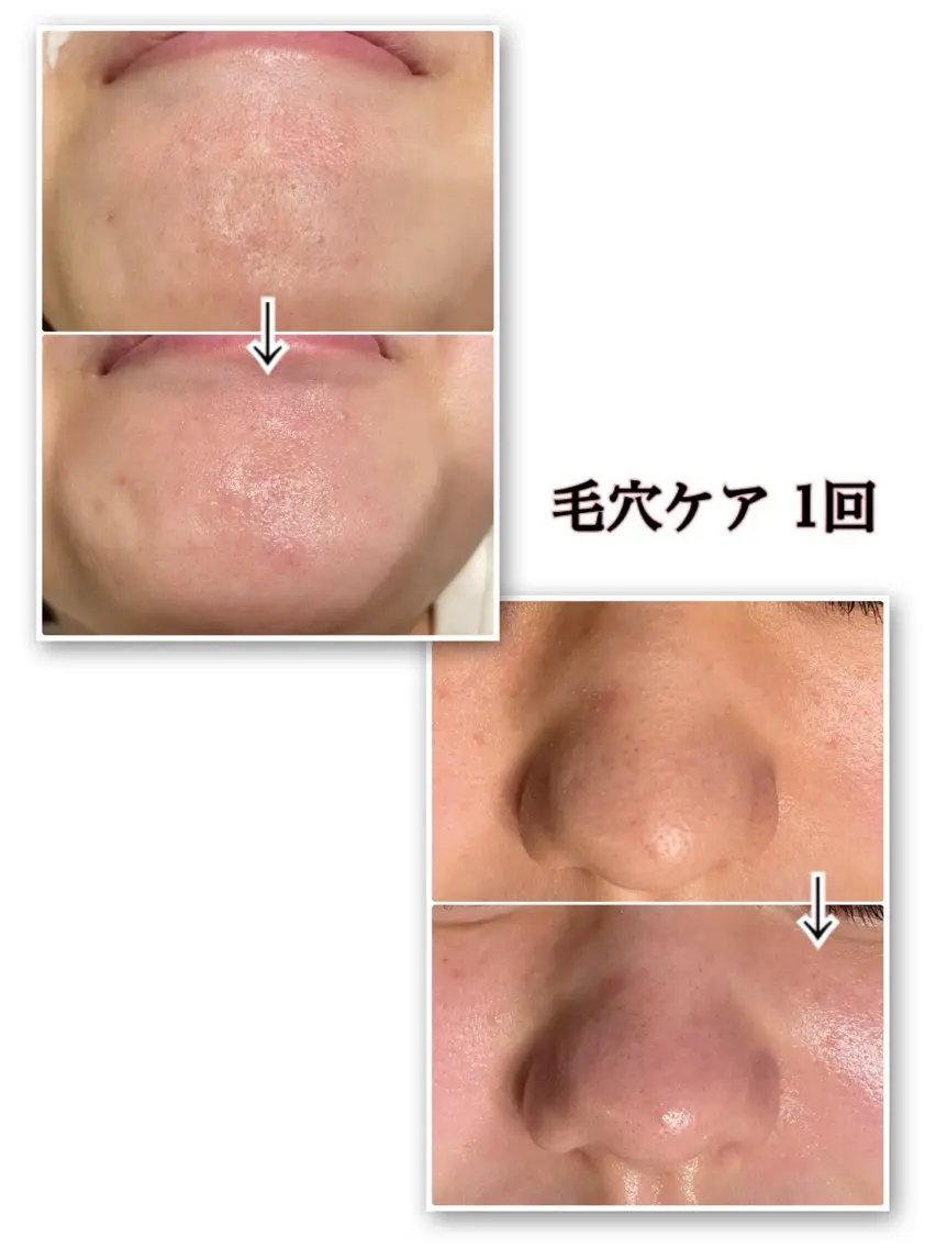 その他 肌改善・脱毛・痩身 LuanaLifeのエステ・リラクイメージ