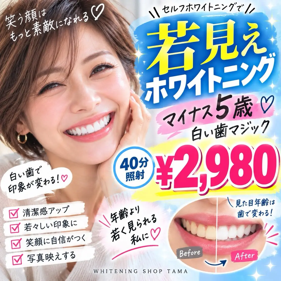✨若見えは口元から♡白い歯で清潔感＆好印象UP🦷大人の40分ホワイトニング¥2,980の写真