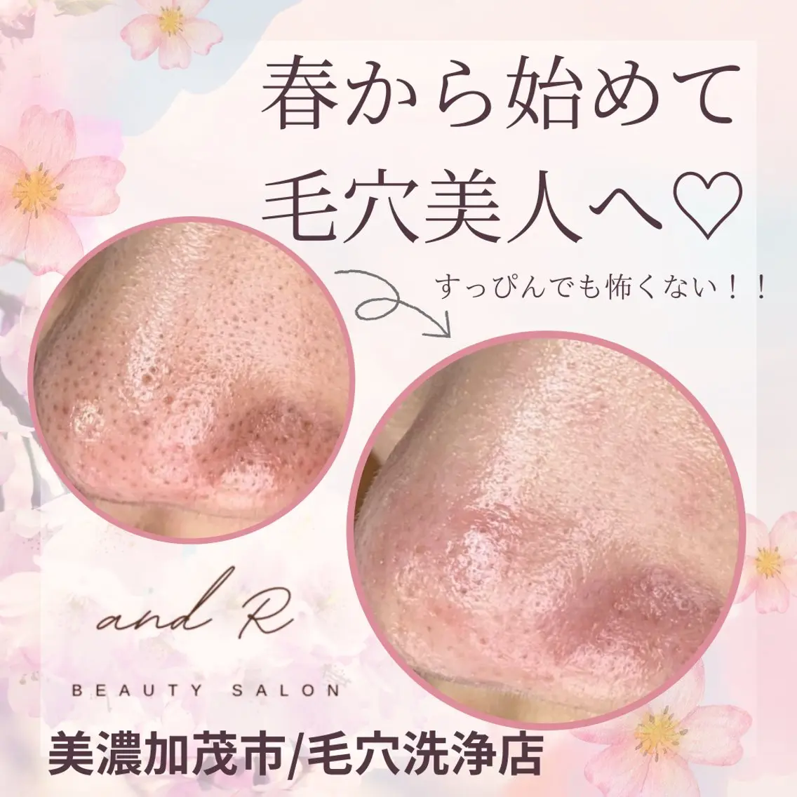 and R 男女 脱毛、毛穴サロンのエステ・リラクイメージ