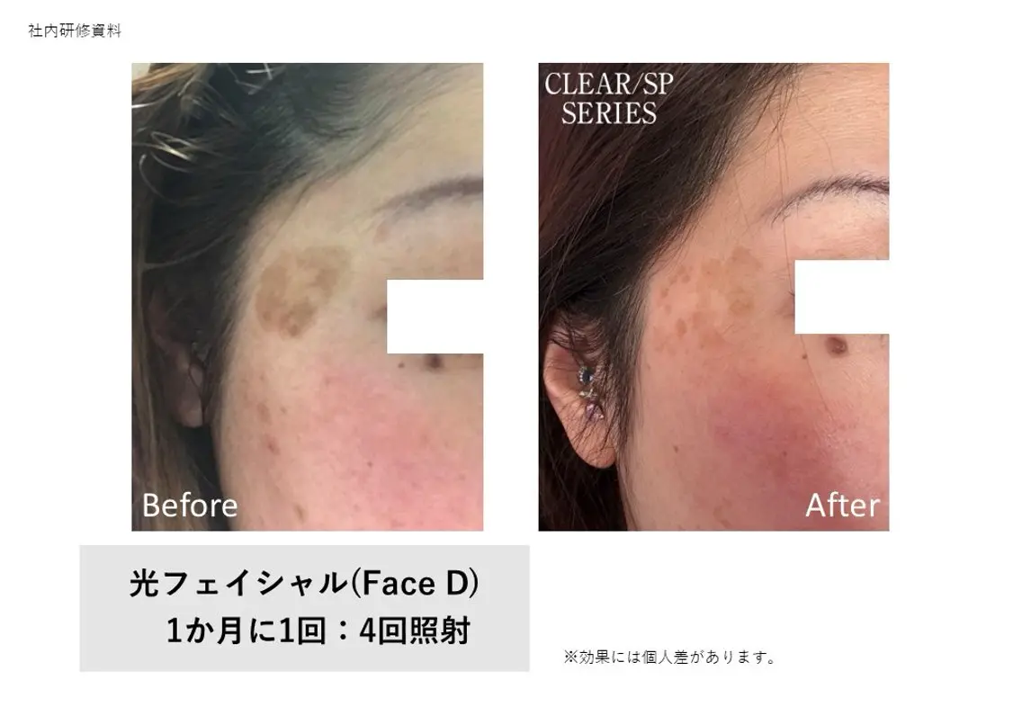 脱毛×肌質改善 M Mondoのエステ・リラクイメージ