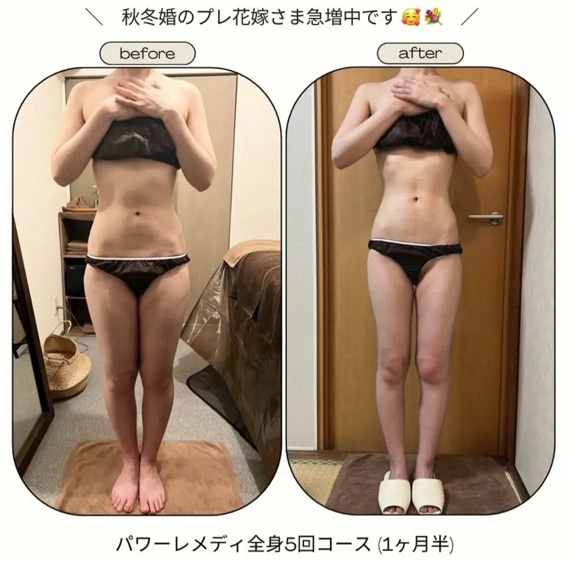 《本気痩せ×疲労改善 》  BILOOPのエステ・リラクイメージ