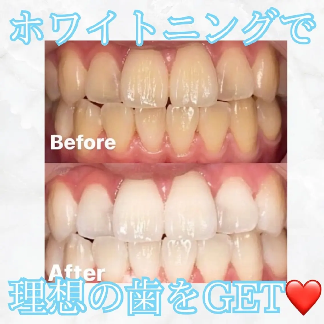 撮影モデル セルフホワイトニング WHITE福岡博多店のエステ・リラクイメージ
