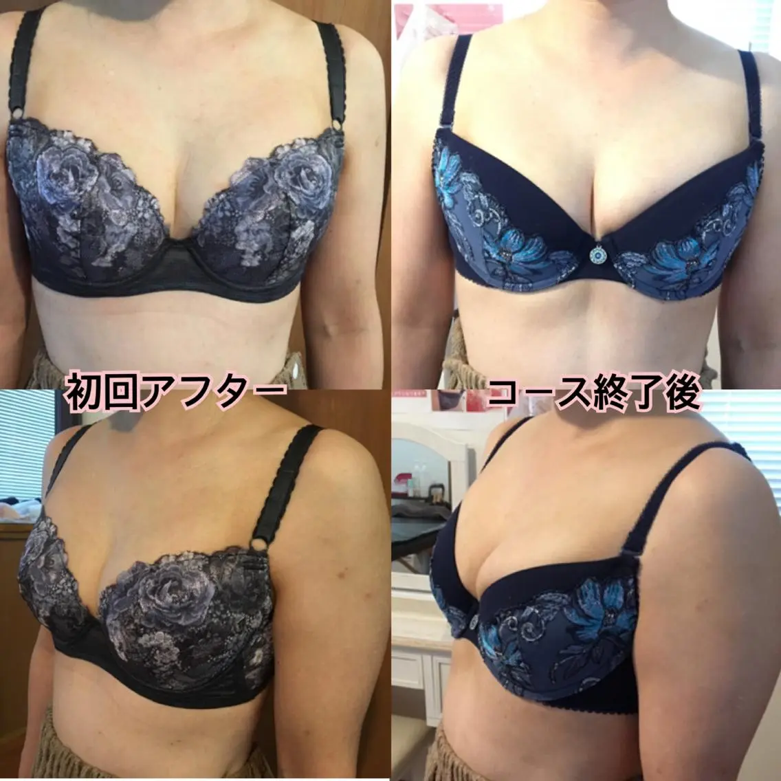 バストアップサロン エミルカのその他イメージ