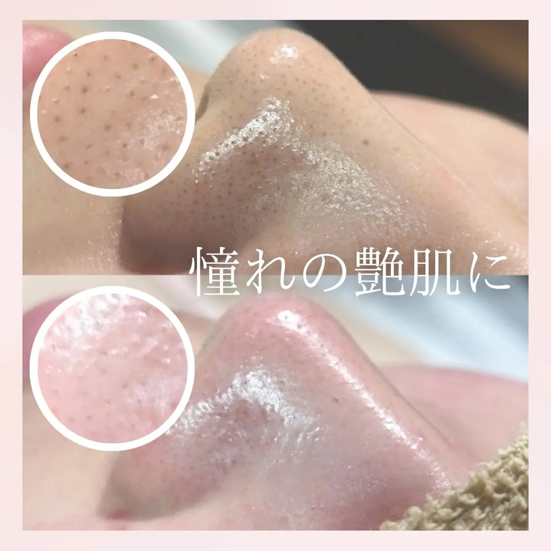 美肌脱毛&毛穴専門 Nico🐰ྀི♡のエステ・リラクイメージ