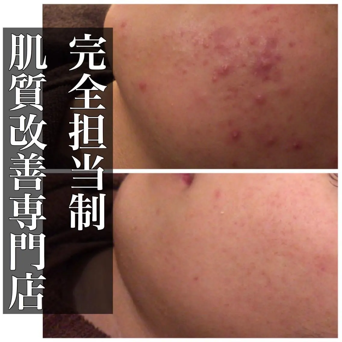 ミディアム カラー パーマ ヘアアレンジ メンズ キッズ ネイル マツエク・マツパ エステ リラク ニキビ・肌質改善専門 ♡人生が変わるサロンのエステ・リラクイメージ