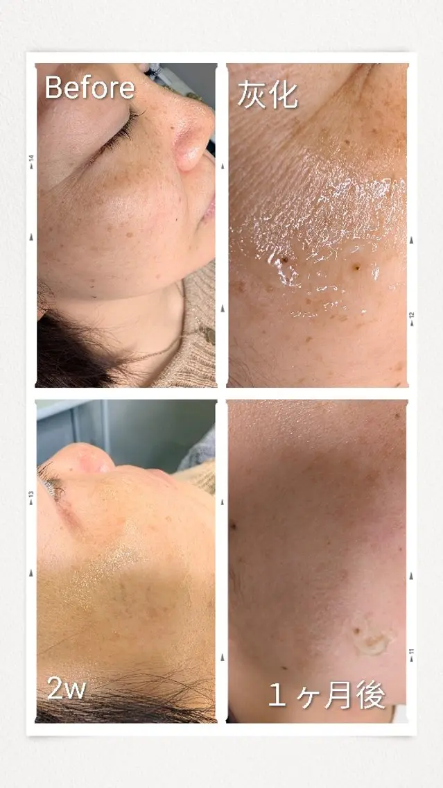 eyelash salon SOLのマツエク・マツパデザイン