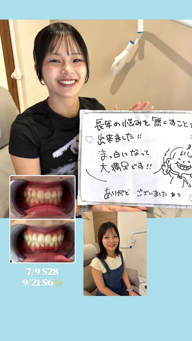 東区香椎歯のセルフホ ワイトニングGLOWのその他イメージ
