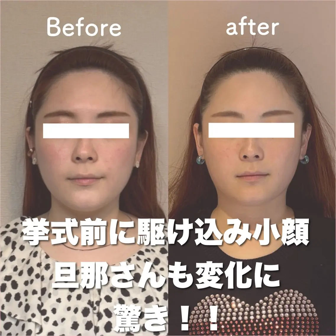 【小顔効果No.1】整形級小顔へ！！ヘッドスパ＋オーダーメイド小顔矯正＋巻き肩改善デコルテオイルマッサージの写真