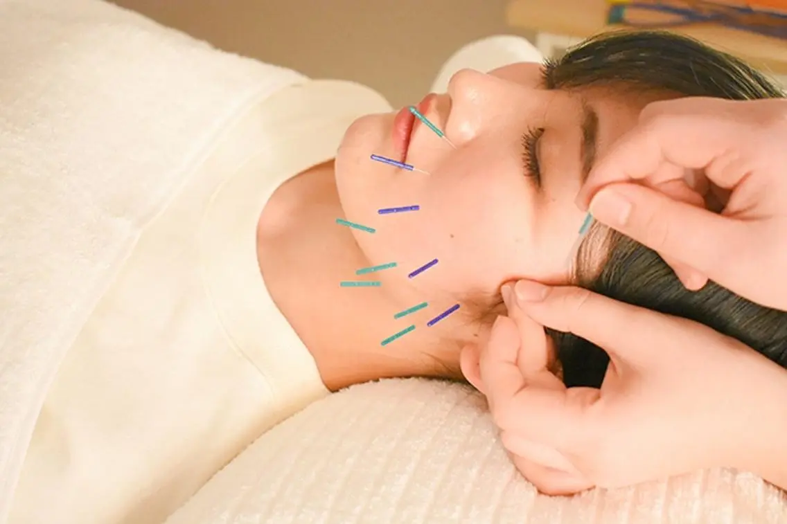 人気No.1【根本ケア★衝撃リフトアップ】小顔美容鍼灸 30分《2回施術》の写真