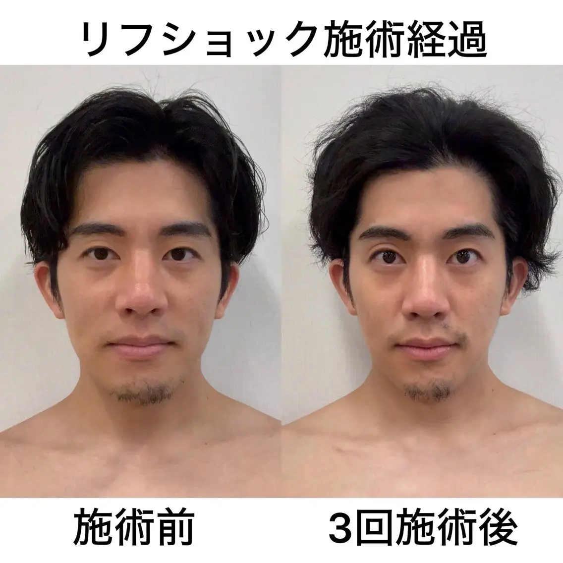 メンズ 本物志向サロンTR ANSBEAUTYのエステ・リラクイメージ
