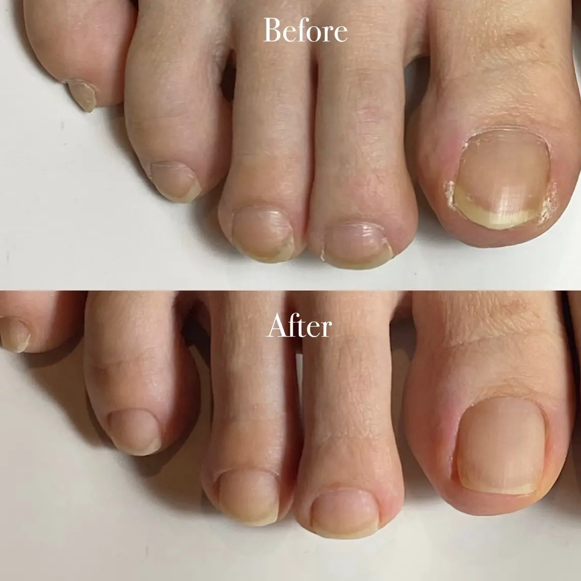 ネイル 長さ出し フットネイル スクエアネイル NailTailor ネイルテイラーのネイルデザイン