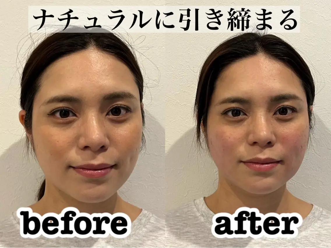 エステ リラク 大阪上本町 肌質改善×美容鍼ゆいのエステ・リラクイメージ