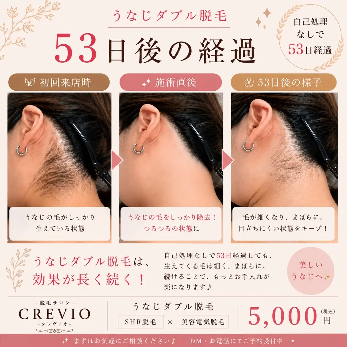 脱毛 脱毛サロン CREVIOのエステ・リラクイメージ