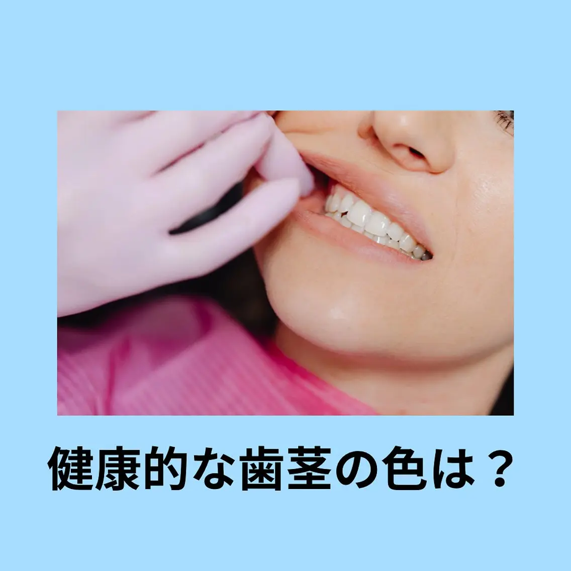 その他 ホワイトニング ショップ津店のその他イメージ